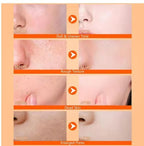 Exfoliating Kojic Acid Turmeric Spray 400 ml Pack of 2